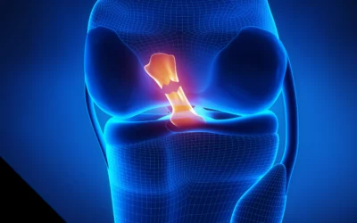 Torn Meniscus Physical Therapy: Recovery and Rehabilitation in Brickell and Davie, FL With Alkemē Sports Rx